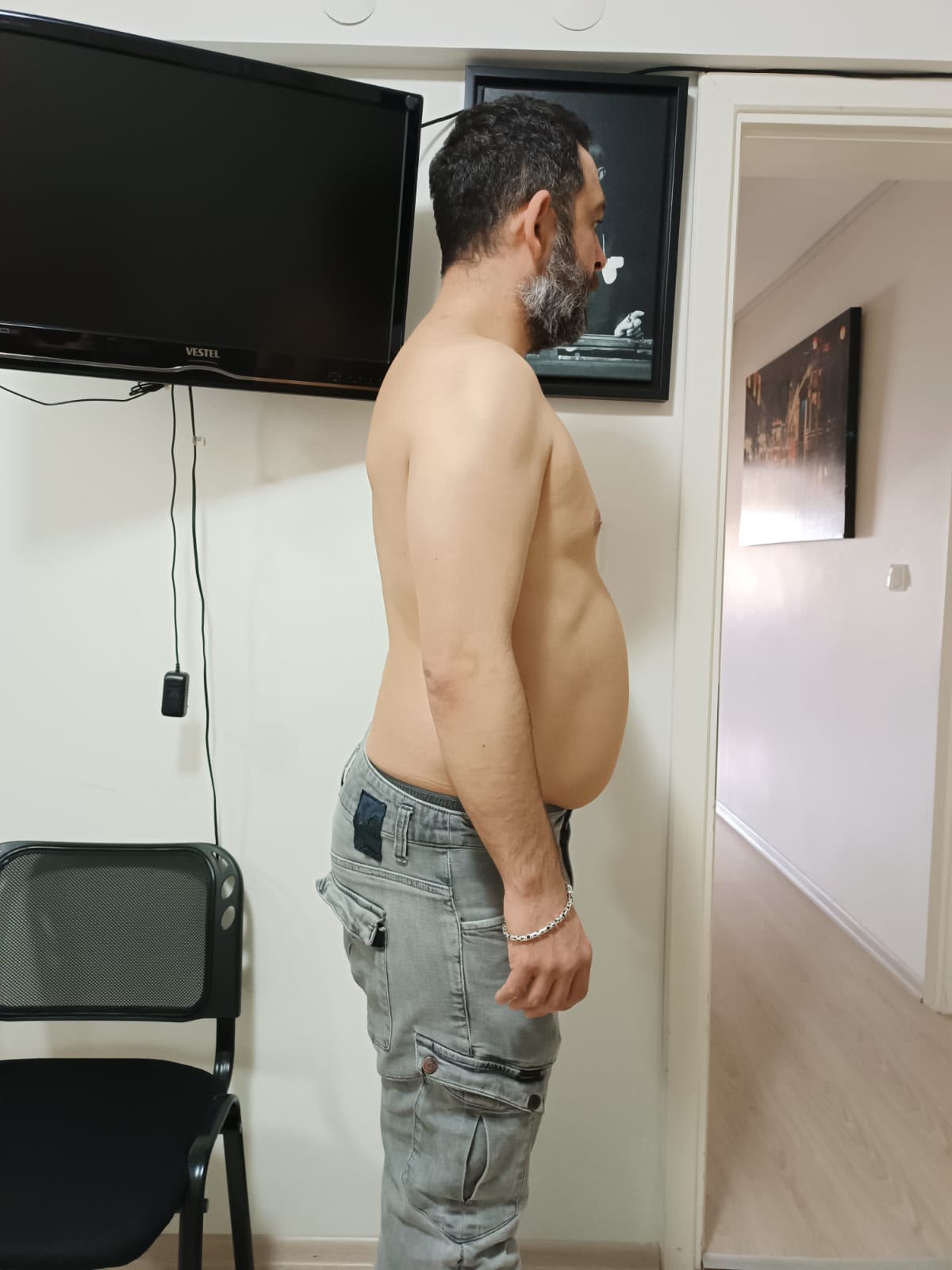 Durmuş Akman öncesi